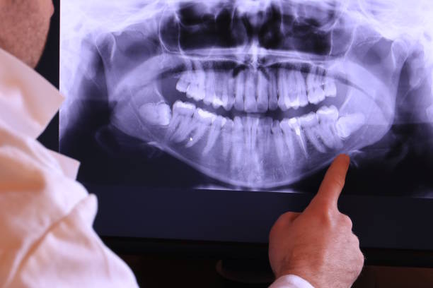 Best Tooth Pain Emergency Relief  in Fitzgerald, GA